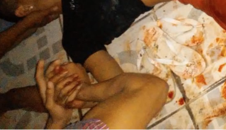 Jovem tem mão decepada ao desobedecer ordem de criminosos no Amazonas 