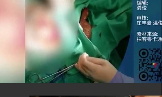 Homem vai parar no hospital com peixe entalado em partes íntimas