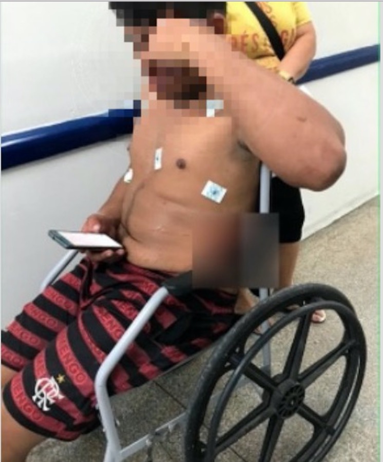 Suspeito de cometer assalto atira contra policiais e leva a pior em Manaus