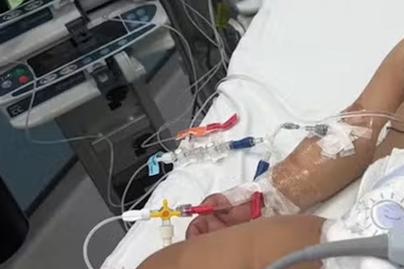 Bebê bebe soda cáustica após confundir garrafa com mamadeira e sofre queimaduras