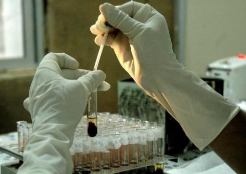 Epidemia de Aids se propaga na Rússia, onde situação é crítica