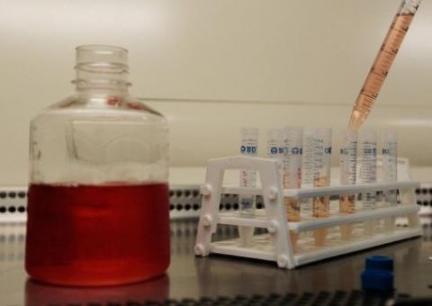 Falha leva EUA a suspender teste com vacina experimental da Aids