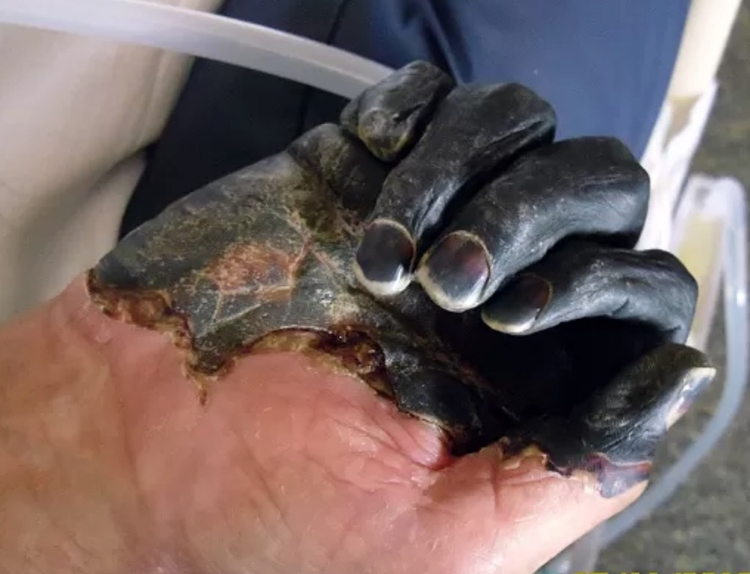 Foto: The Gaylord Family/AP