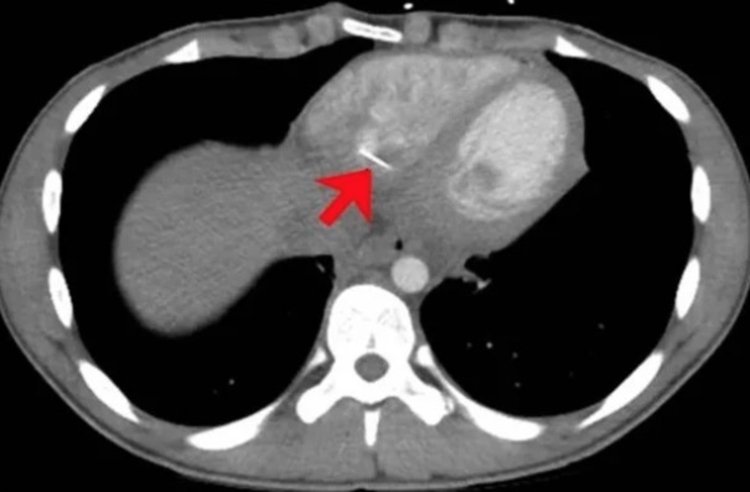 Foto: Reprodução/TJEM