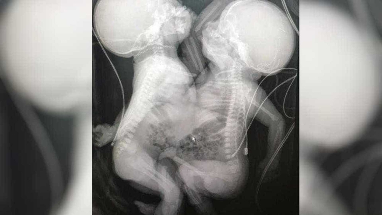 Foto: Reprodução Arquivo pessoal