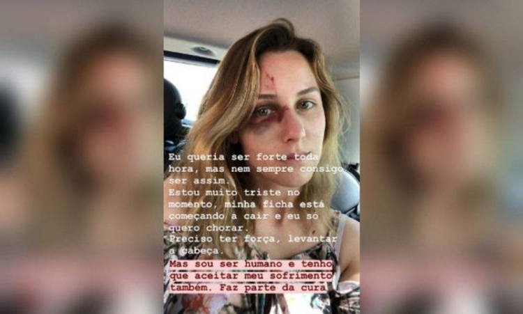 Foto: Reprodução/ Redes Sociais