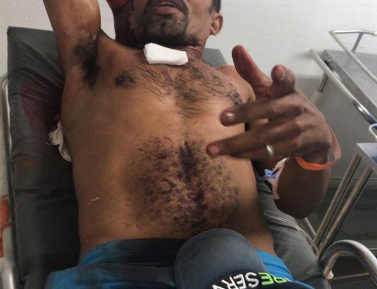 Homem foi suturado na altura do tórax - Foto: Divulgação/Polícia Civil de Pernambuco