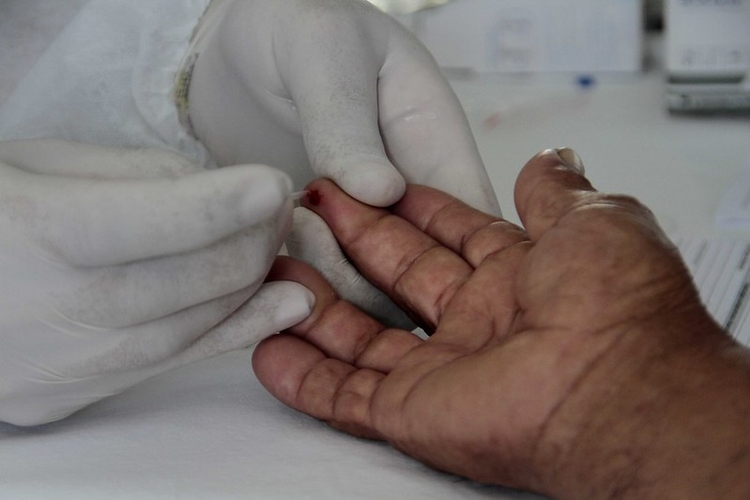 Foto: Altemar Alcântara/ Semcom