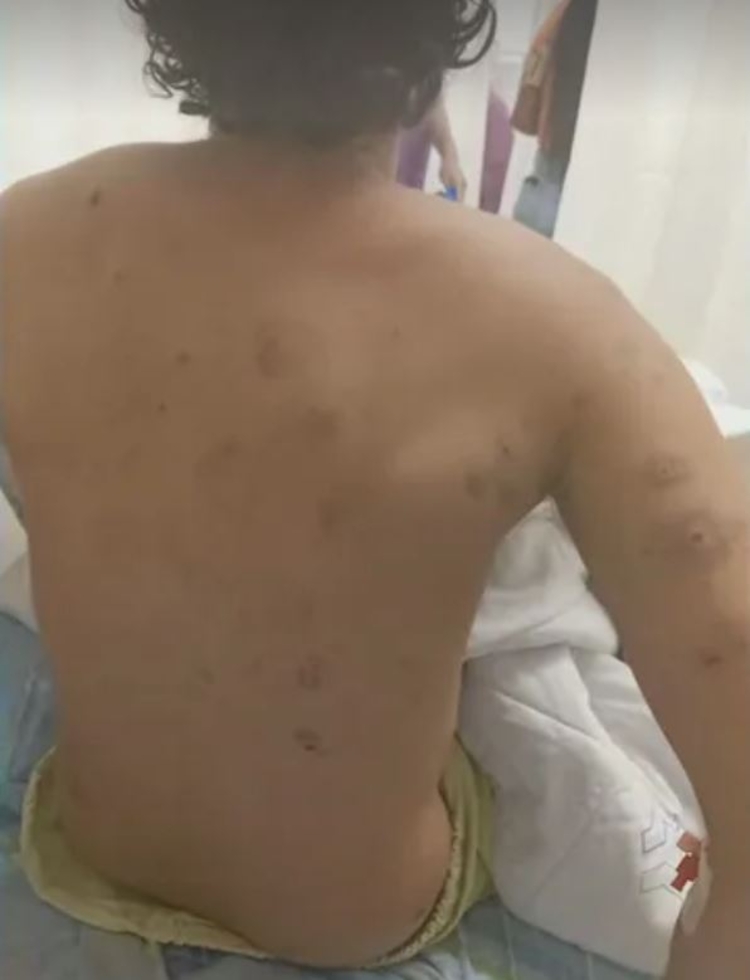 Rafael foi atingido por estilhaços de granada - Foto: Divulgação