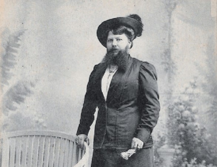 Foto: Divulgação /  Clementine Delait tinha problemas hormonais