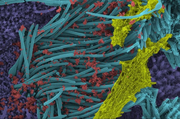 Vírus toma o pulmão - Foto:UNC School of Medicine