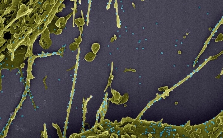 Análises - Foto: Fiocruz