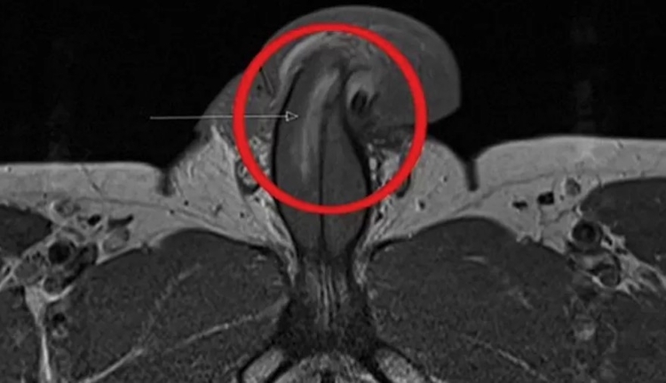 Foto: Reprodução / British Medical Journal