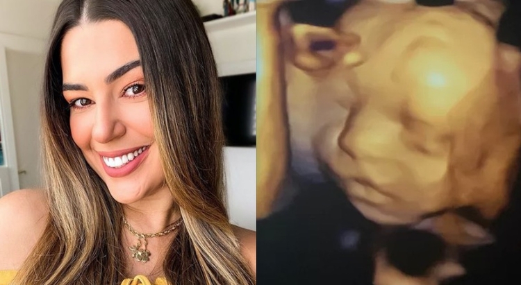 Vivian Amorim mostra rosto da filha em ultrassom 3D - Foto: Reprodução/Instagram