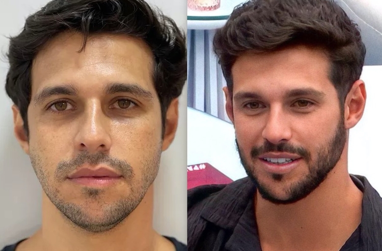 Antes e depois Rodrigo Mussi - Foto: Reprodução/Divulgação/Rede Globo