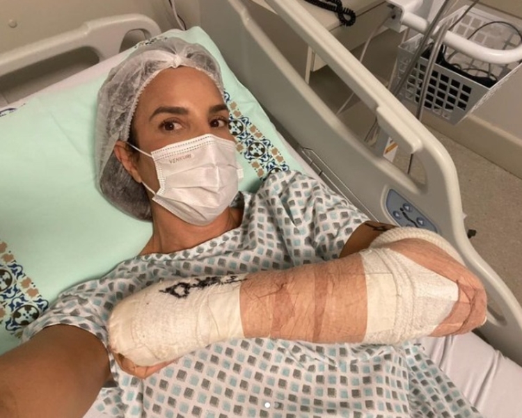 Ivete passou por cirurgia no braço - Foto: Reprodução/Instagram