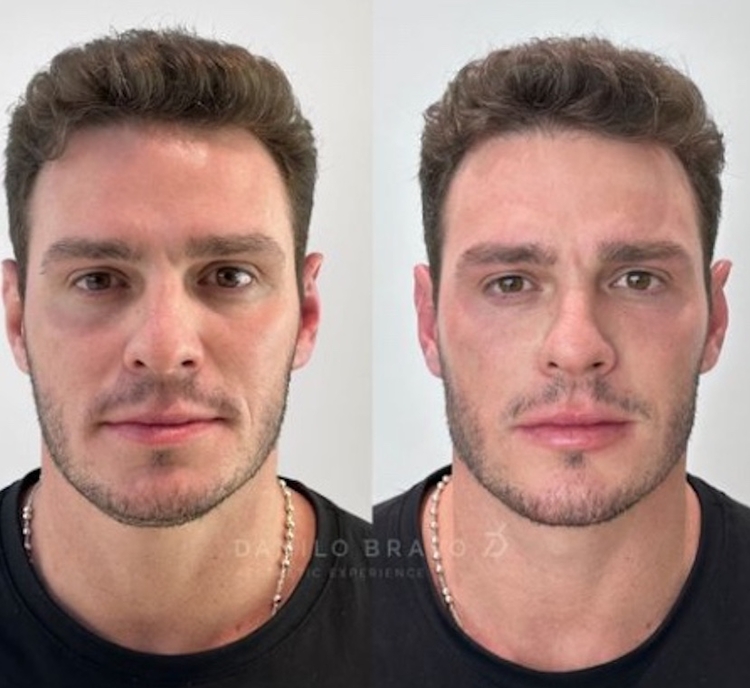 Foto: Reprodução/Instagram