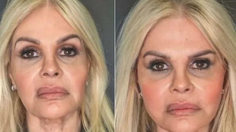 Antes e depois de Monique Evans - Imagens: Reprodução/Instagram