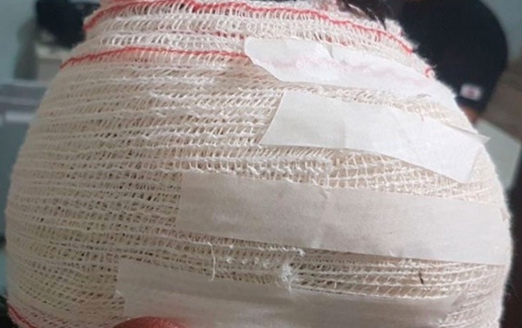 Foto ilustrativa: Divulgação