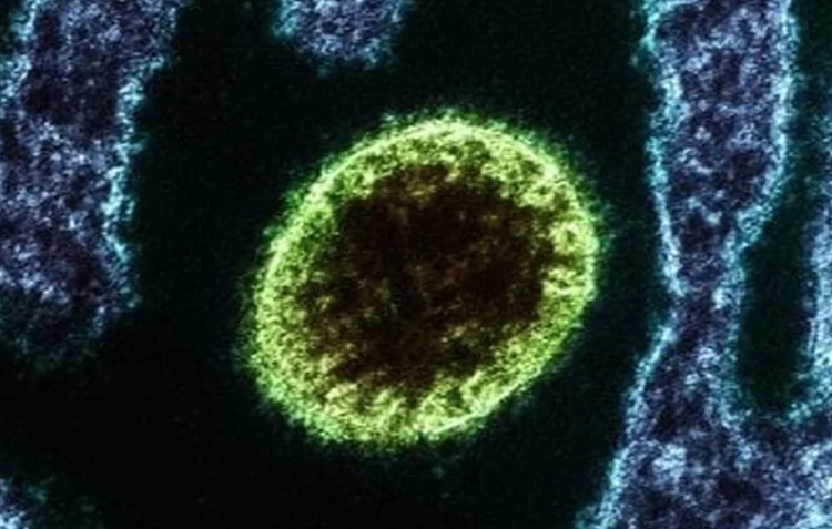 Foto: Reprodução/ Instituto Nacional de Alergia e Doenças Infecciosas dos EUA