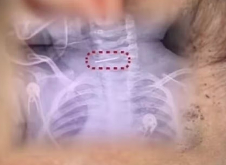 Foto: Reprodução/Redes Sociais