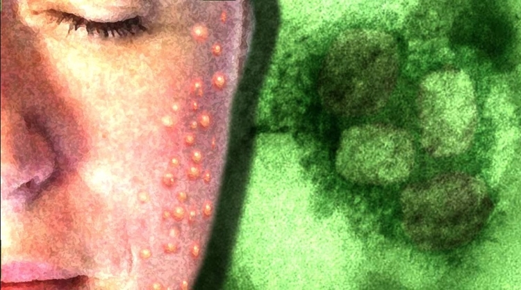 Imagem: Liminha Júnior