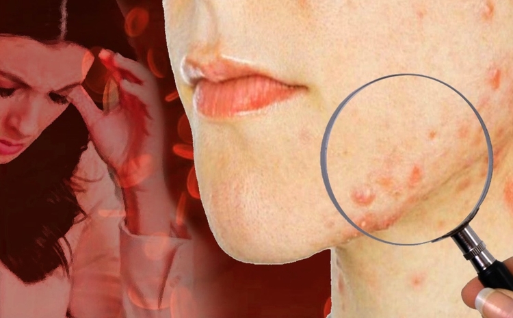 Imagem: Liminha Júnior