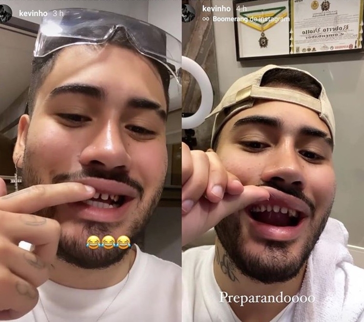 Kevinho mostrou sorriso ao 'natural' e chocou fãs - Foto: Reprodução/ Instagram