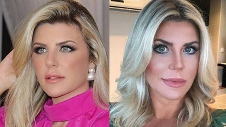 Ex-BBB surgiu com o rosto diferente em rede social - Foto: Reprodução/ Instagram 