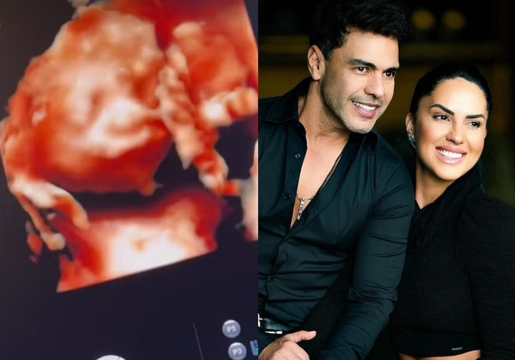 Foto: Reprodução/Instagram 