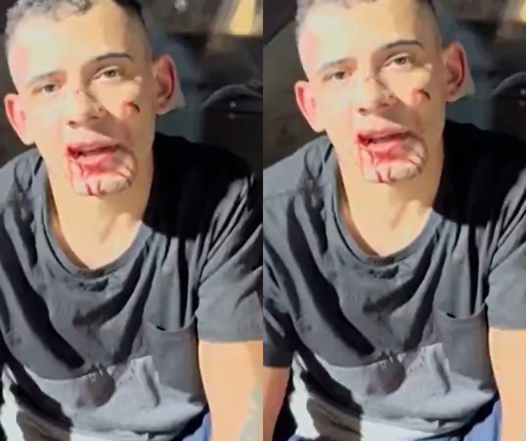 Douglas Alves da Silva afirma que pretendia atropelar outra pessoa / Foto: Reprodução de vídeo