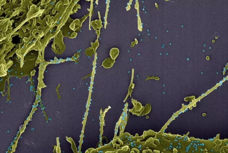 Vírus se espalha rapidamente - Foto: LMMV/IOC/Fiocruz