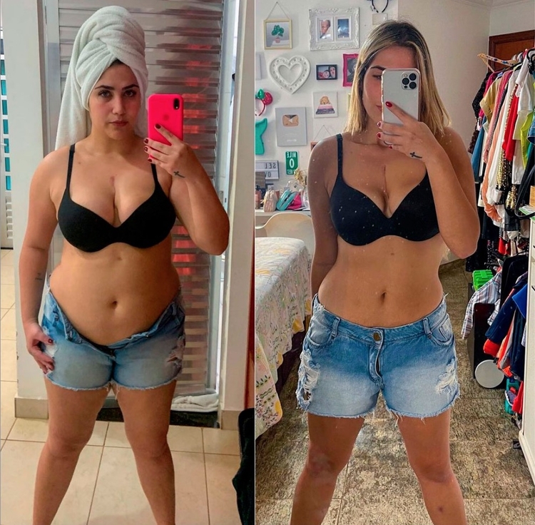 Jéssica Costa mostrou o antes e depois - Foto: Reprodução Instagram