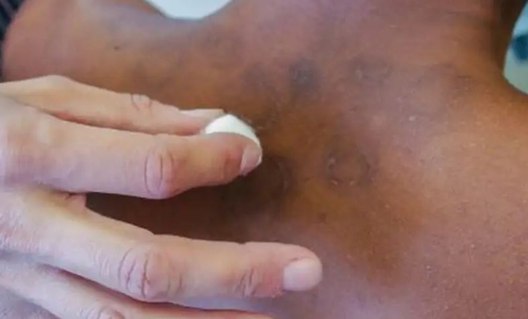 Foto: SMS de Mesquinta RJ