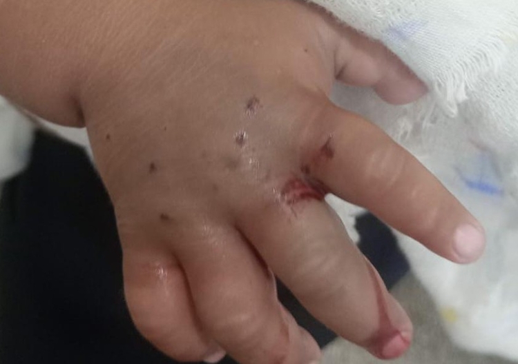 Local da picada - Foto: Divulgação 