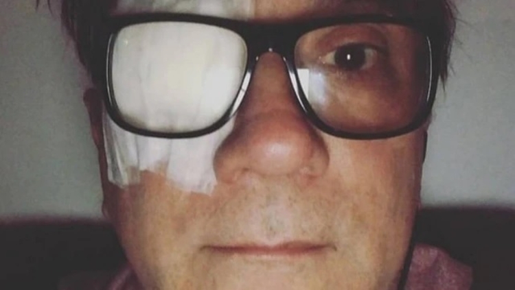 Bruno Gouveia, vocalista do Biquini Cavadão, informou que descobriu tumor em janeiro e só fez a cirurgia na última quarta, 18. Foto: Instagram/@biquini