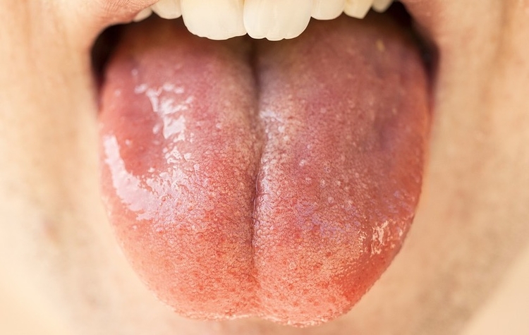 Transmissão do coronavírus pela saliva - Imagem: Ilustrativa/Pixabay 
