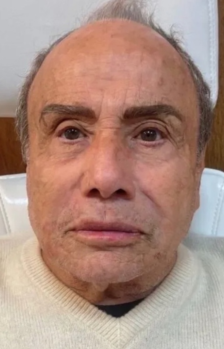 Stenio Garcia pós harmonização - Foto: Reprodução/Instagram