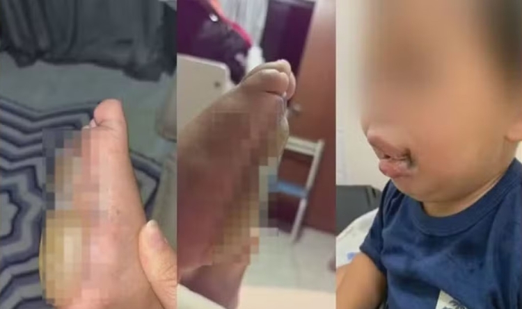 Imagens mostram dois bebês - um sofreu queimaduras nos pés e outro foi vítima de choque /Foto: Reprodução/TV Globo