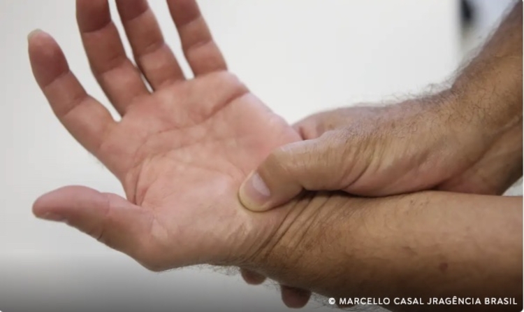 Lúpus é uma doença autoimune crônica que pode causar inflamação e dor - Foto: Agência Brasil