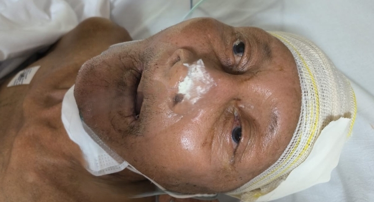 Foto: Divulgação / SES-AM