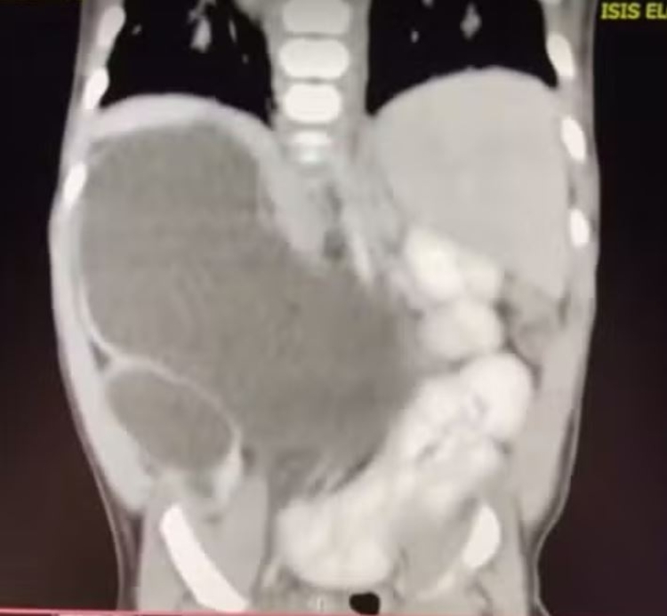 Foto: Arquivo pessoal/Thalia Silva Alves