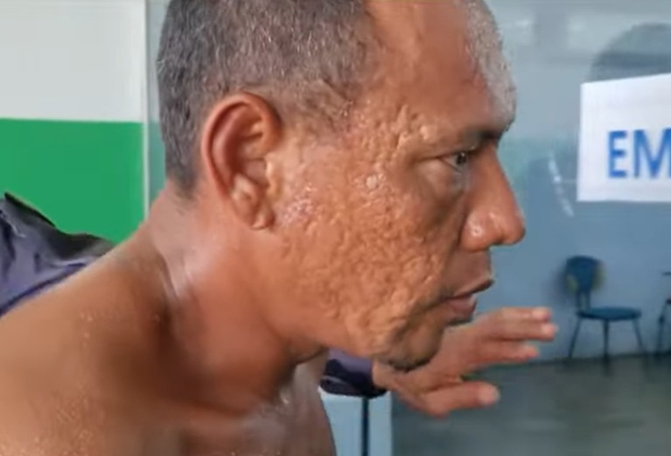 Homem tentou se esconder - Foto: Reprodução