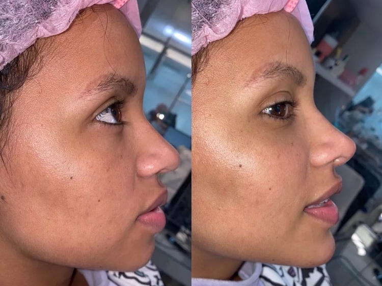 Antes e depois Gleici Damasceno - Foto: Reprodução Instagram