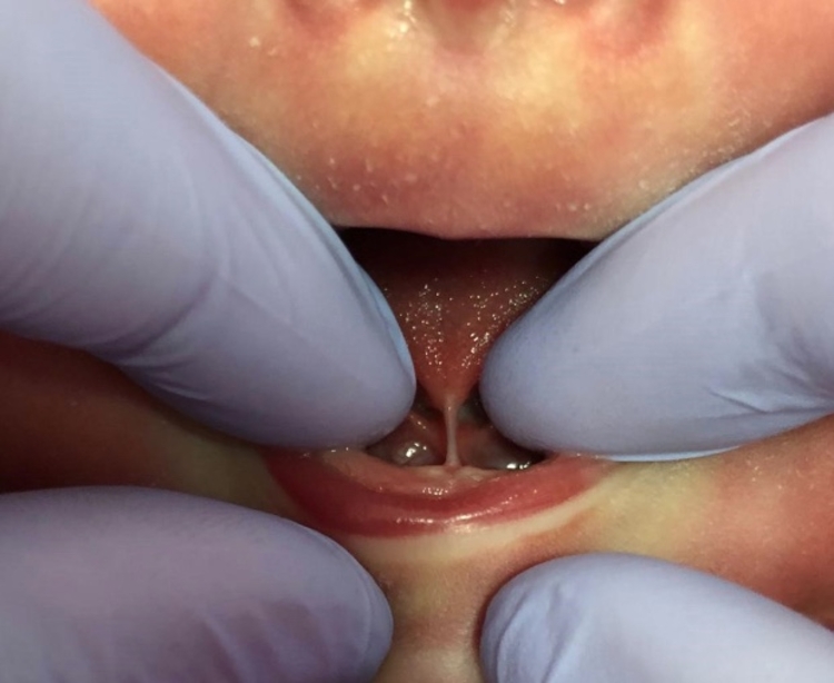 Foto: Reprodução/SIQUEIRA, B., et al.