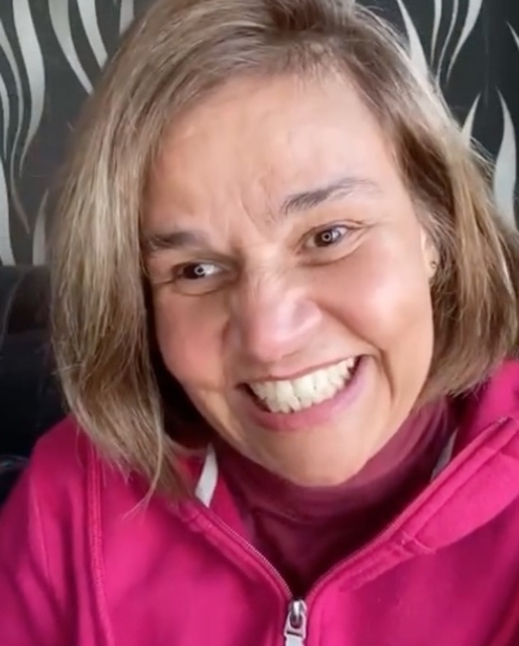 Claudia Rodrigues foi diagnosticada com esclerose múltipla desde 2000 - Imagem: Instagram