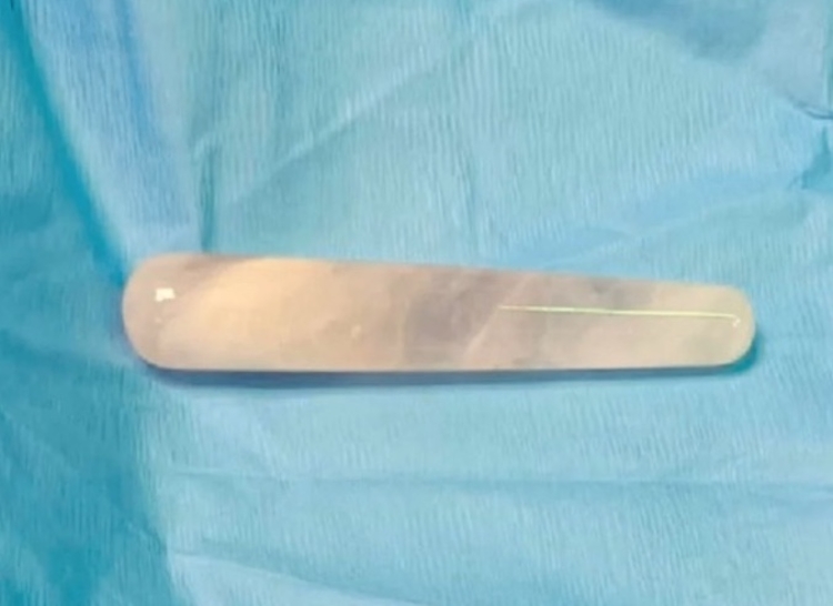 Vibrador de cristal Foto: Shaare Zedek Medical Center / Divulgação