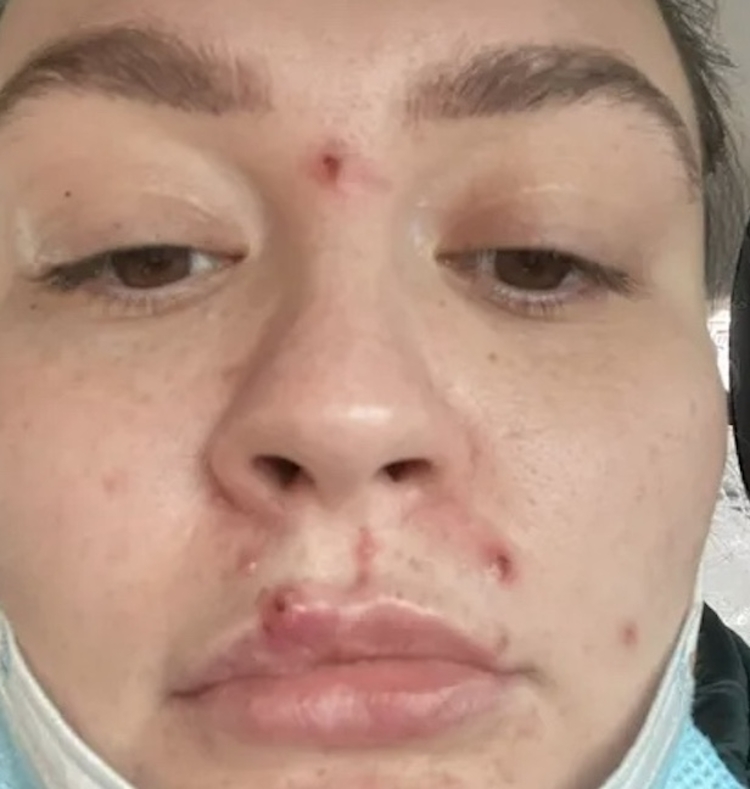 Foto: Reprodução/Kennedy News