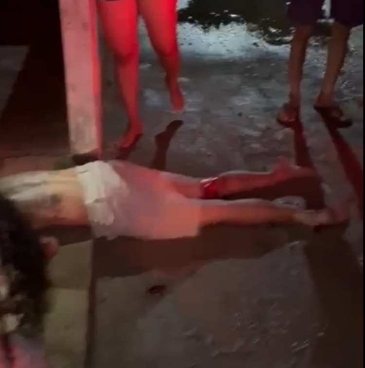 Vítima fraturou as pernas - Foto: Divulgação 