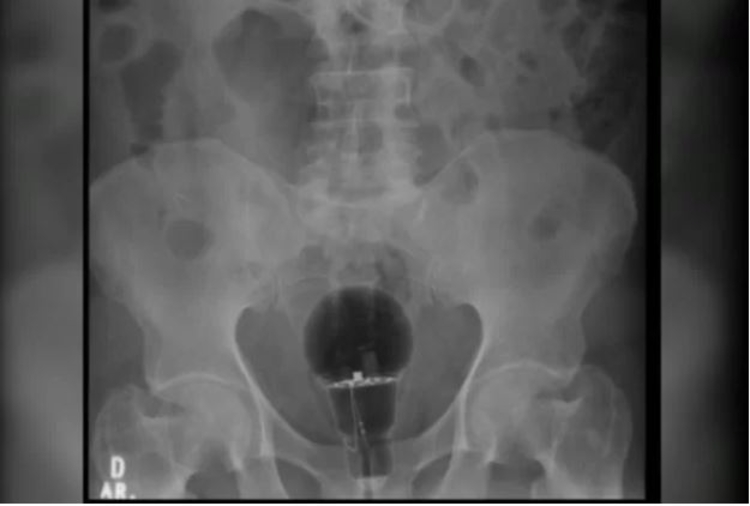 Foto: Reprodução / Twitt